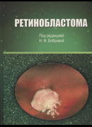 Ретинобластома