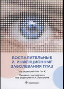 Воспалительные и инфекционные заболевания глаз