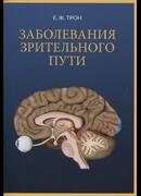 Заболевания зрительного пути