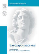 Блефаропластика