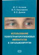 Использование политетрафторэтиленовых имплантатов в офтальмохирургии