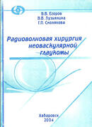 Радиоволновая хирургия неоваскулярной глаукомы