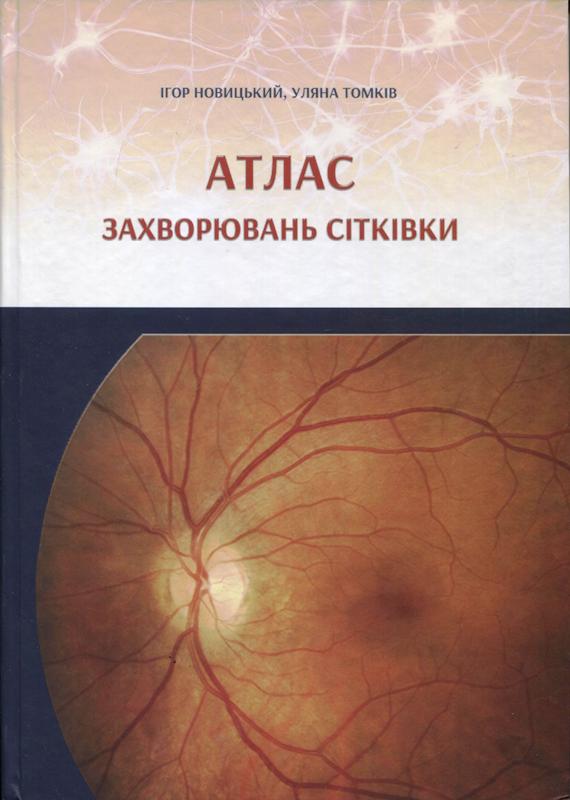 Атлас захворювань сітківки