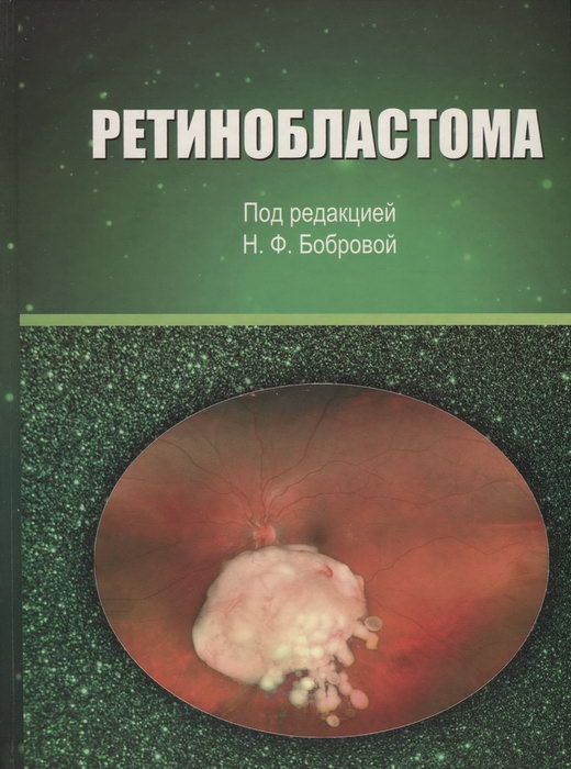 Ретинобластома
