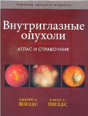 Внутриглазные опухоли. Атлас и справочник